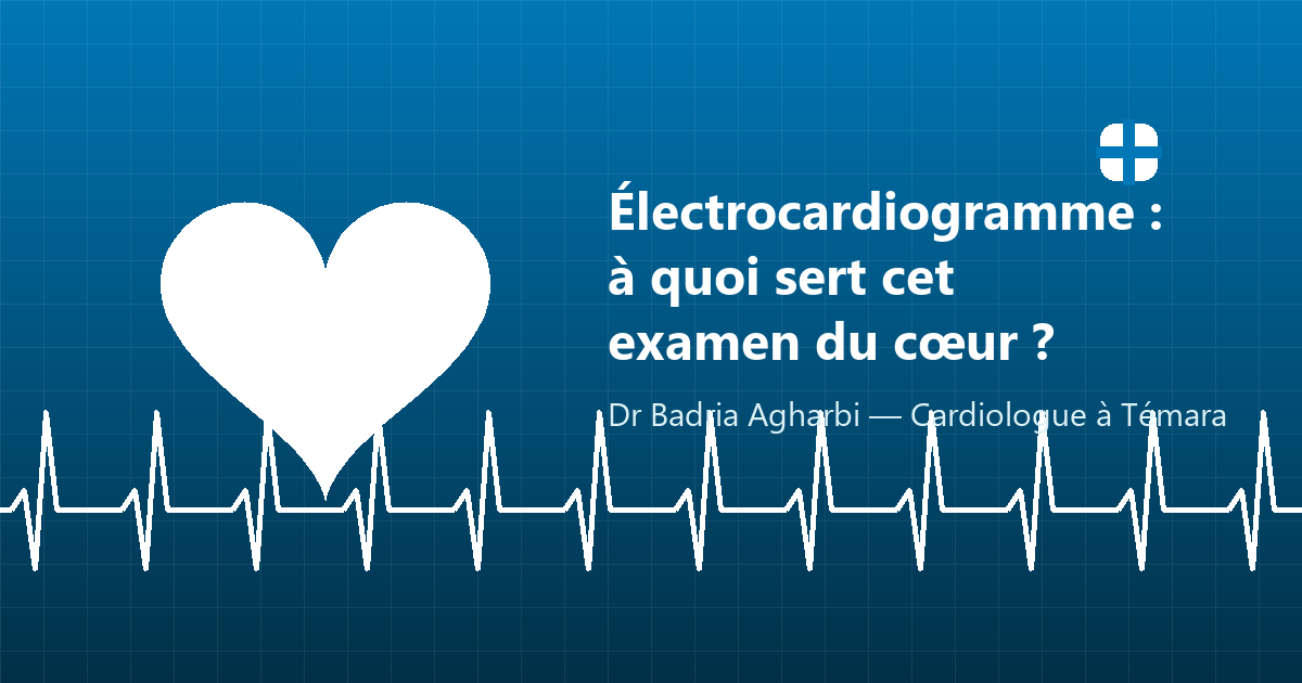 Électrocardiogramme (ECG) : à quoi sert cet examen du cœur ?