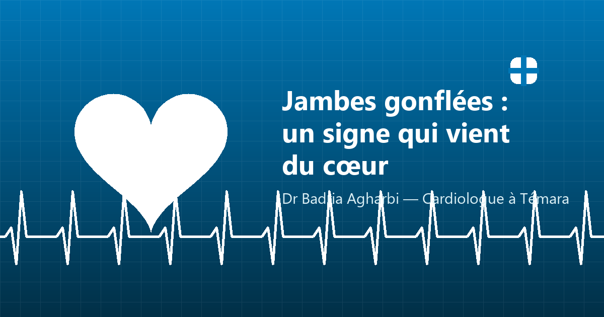 Jambes gonflées (œdèmes) : un signe qui peut venir du cœur